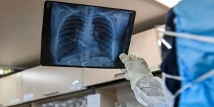 ثبت یک فوتی کرونایی با گذشت ۲۱ روز در مازندران